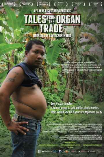 Tales from the Organ Trade | 2013